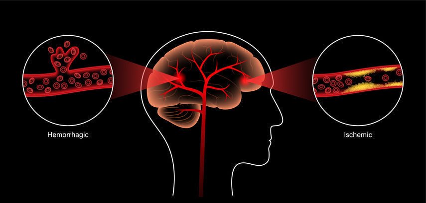 Voordelen van Roodlichttherapie voor de Hersenen: Gids 2025 voor Cognitieve Gezondheid