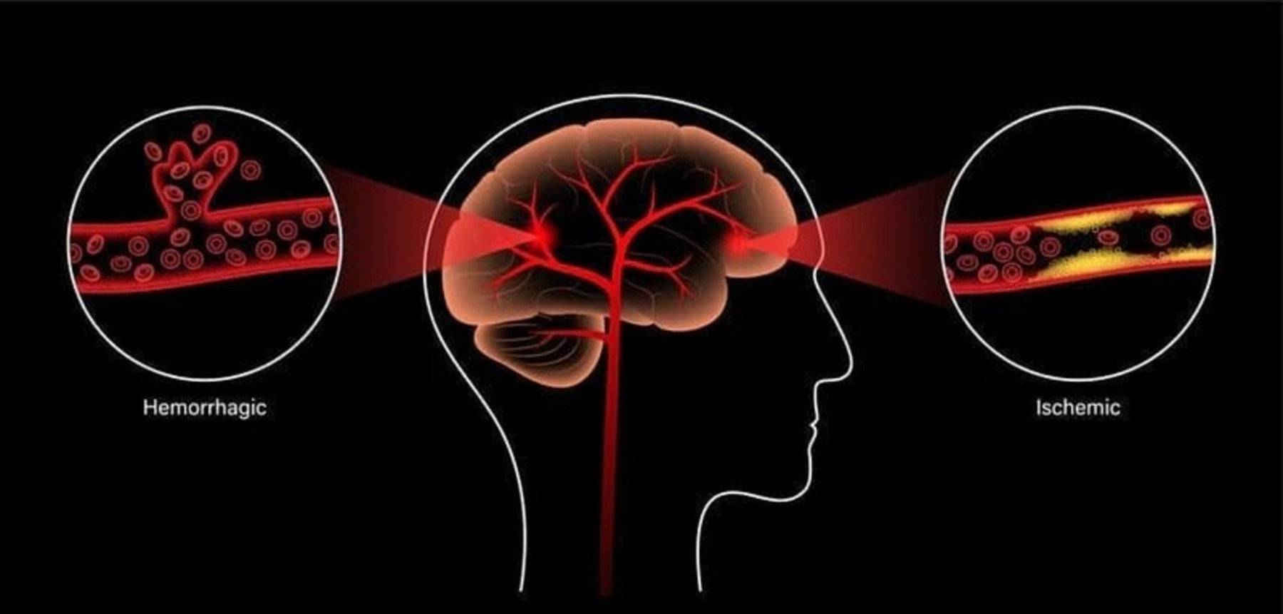 Voordelen van Roodlichttherapie voor de Hersenen: Gids 2025 voor Cognitieve Gezondheid