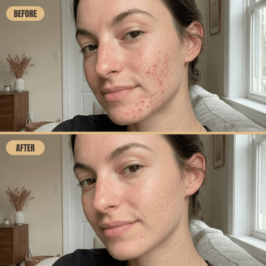 Wat Gebeurt er in de Remodelleringsfase van een Wond? - Mvolo