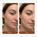 LED Face Mask + Halsmasker - Mvolo