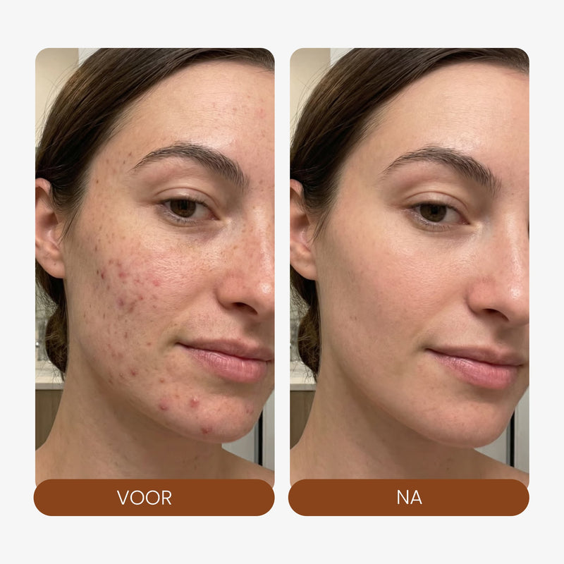 LED Face Mask + Halsmasker - Mvolo