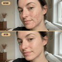 LED Face Mask Lite - Mvolo